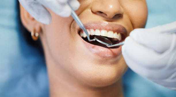Best Orthodontic Emergency Dentist in Maysville, MO