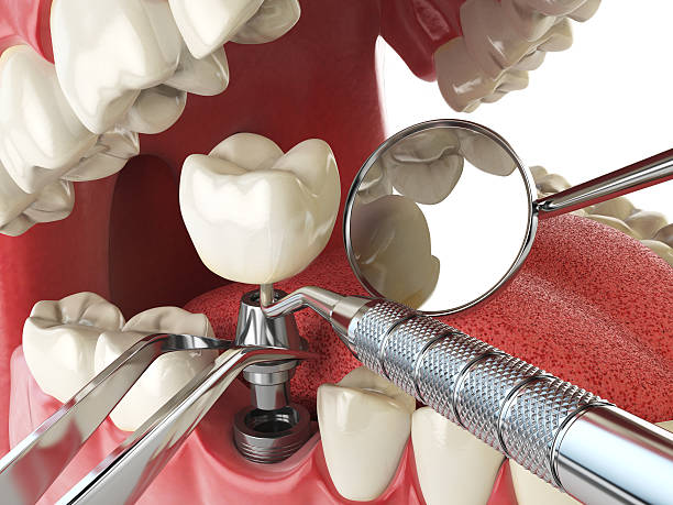 Best Emergency Dental Extractions in Maysville, MO